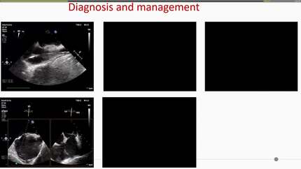 Presentation thumbnail