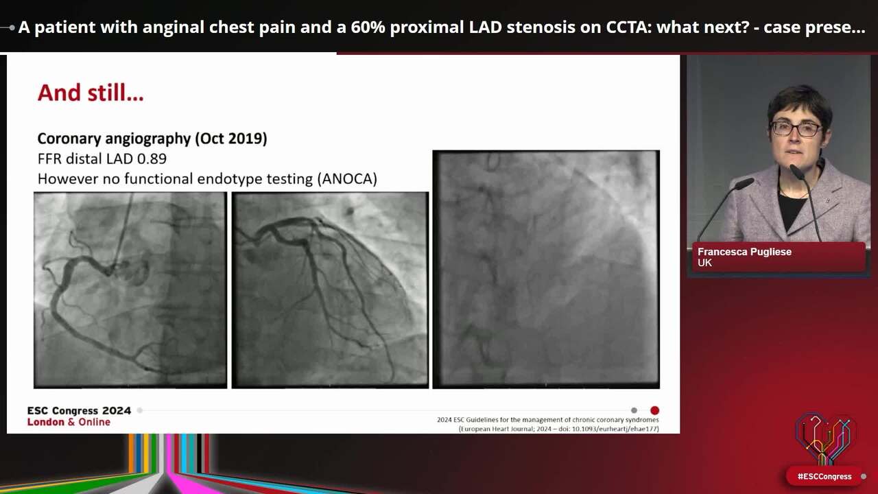 A patient with anginal chest pain and a 60% proximal LAD stenosis on CCTA: what next? - case presentation