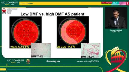 Global longitudinal strain is an accurate marker of diffuse myocardial fibrosis in aortic stenosis: a comparison with targeted left ventricular myocardial biopsy and T1 mapping