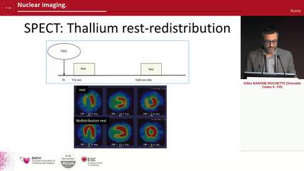 Nuclear imaging.