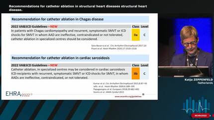 Ventricular tachycardia (VT) guidelines