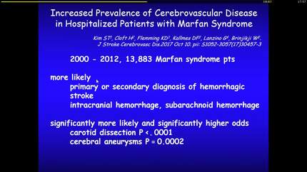 Marfan Syndrome, its not only the aorta wich is affected.