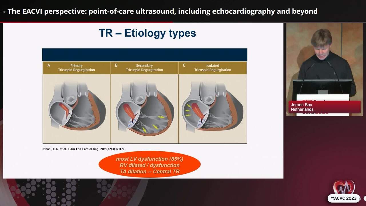 My patient has RV failure: different perspectives for a unified diagnostic/therapeutic pathway