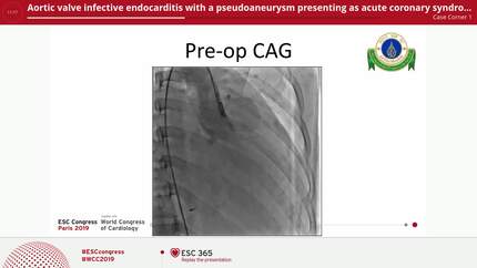 Presentation thumbnail