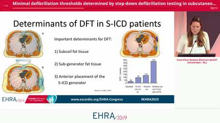Minimal defibrillation thresholds determined by step-down defibrillation testing in subcutaneous implantable-defibrillator patients during implantation and replacement.