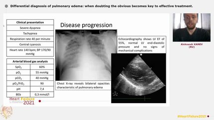 Differential diagnosis of pulmonary edema: when doubting the obvious becomes key to effective treatment.