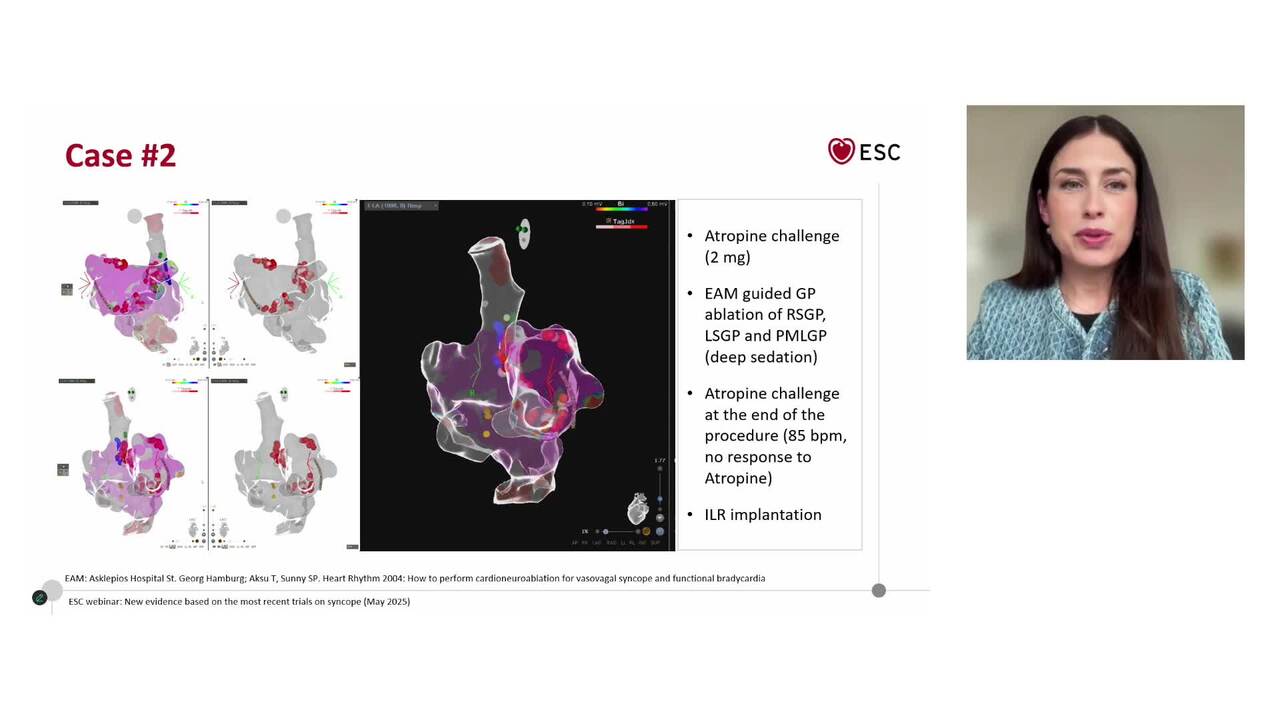 New evidence based on the most recent trials on syncope