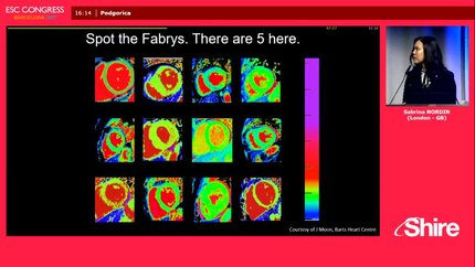 How to read cardiac MRI in Fabry patients.