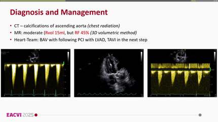Presentation thumbnail