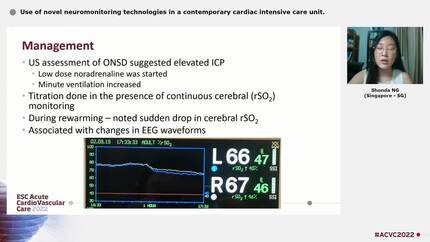 Use of novel neuromonitoring technologies in a contemporary cardiac intensive care unit.