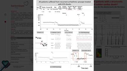 Atrial tachyarrhythmias with ultra-rapid ventricular response in patients with a structurally normal heart: a new and distinct entity in the spectrum of sudden cardiac death?
