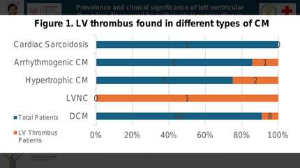 Prevalence and clinical significance of left ventricular thrombus discovered by pathological examination in explanted hearts of patients with end-stage cardiomyopathy