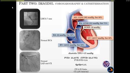 Presentation thumbnail