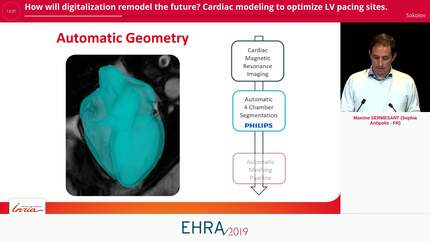 How will digitalization remodel the future?
Cardiac modeling to optimize LV pacing sites.