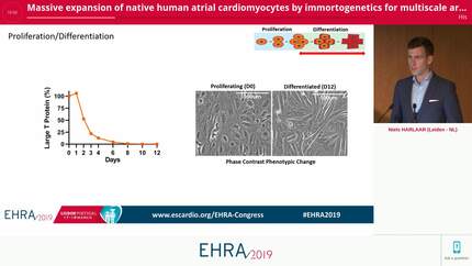 Massive expansion of native human atrial cardiomyocytes by immortogenetics for multiscale arrhythmia research