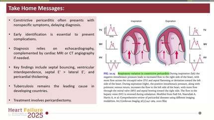 The hidden threat of constrictive pericarditis: a rare condition with severe long-term effects