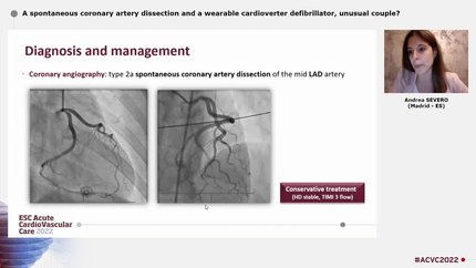 A spontaneous coronary artery dissection and a wearable cardioverter defibrillator, unusual couple?