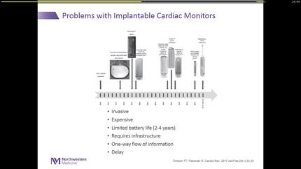 Novel AF monitoring tools.
