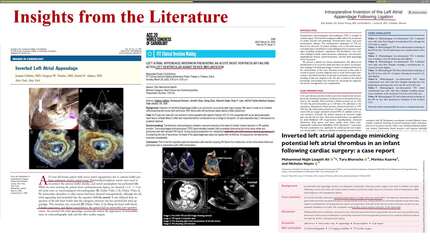 When stroke points to the heart: solving the diagnostic puzzle of inverted left atrial apendage with multimodality imaging