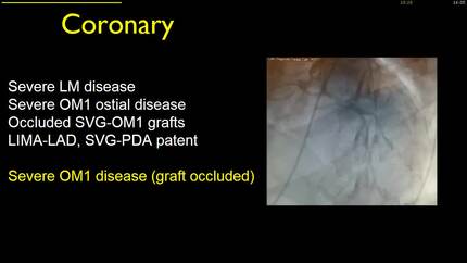 Presentation thumbnail