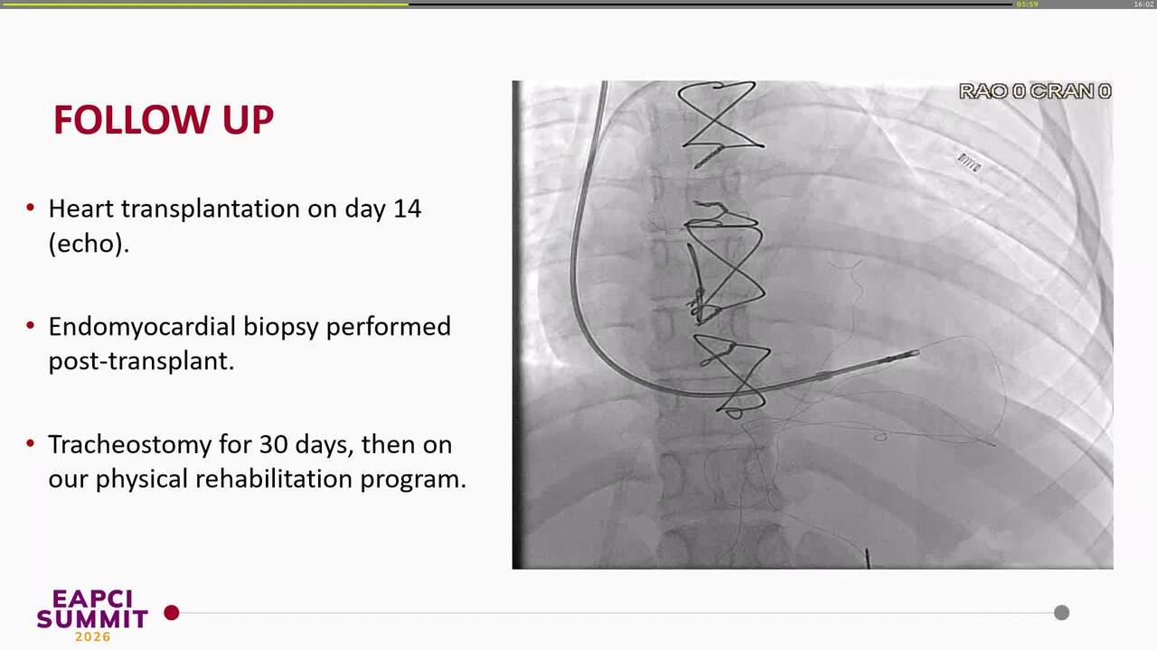 Left ventricular assist device escalation and cerebral protection device usage in a cardiogenic shock patient.
