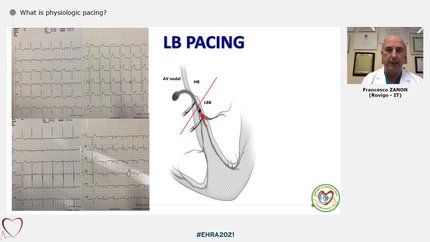 Presentation thumbnail