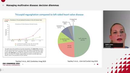 Mitral regurgitation and tricuspid regurgitation: treatment options and algorithms.