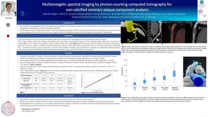 Spectral photon counting computed tomography imaging for non-calcified coronary plaque characterization