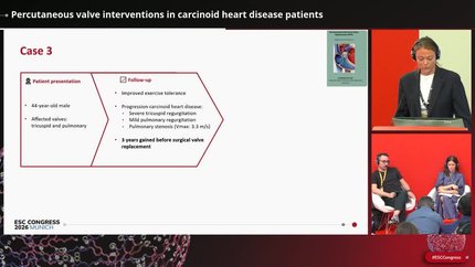 Valvular manifestations of systemic diseases (1)