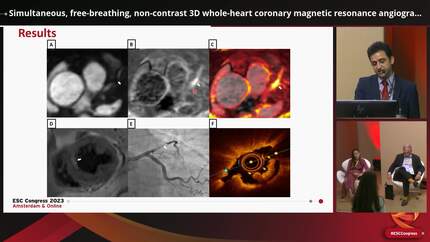Simultaneous, free-breathing, non-contrast 3D whole-heart coronary magnetic resonance angiography and vulnerable plaque imaging in patients with suspected acute coronary syndrome