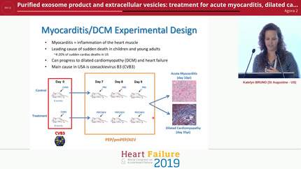 Purified exosome product and extracellular vesicles: treatment for acute myocarditis, dilated cardiomyopathy and heart failure