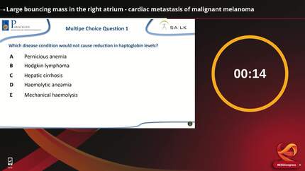 Large bouncing mass in the right atrium - cardiac metastasis of malignant melanoma
