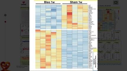 Time-course of cardiac gene profiles post-acute lung injury