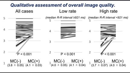 Qualitative and quantitative assessment of deep learning-based raw data motion correction in atrial fibrillation: benefit in high heart rate and motion-prone segments
