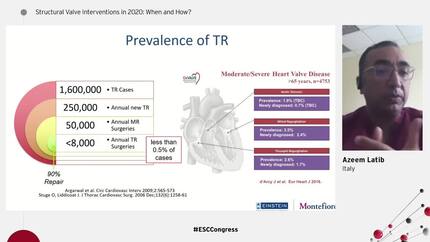 Structural Valve Interventions in 2020: When and How?