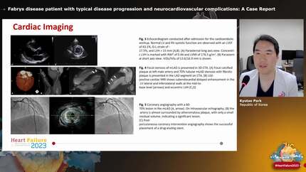 Fabrys disease patient with typical disease progression and neurocardiovascular complications: A Case Report
