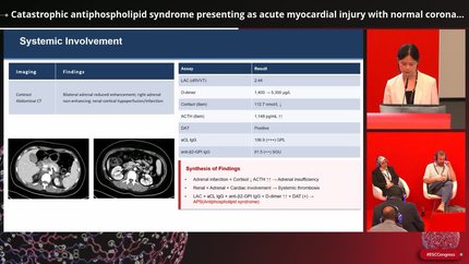 Catastrophic antiphospholipid syndrome presenting as acute myocardial injury with normal coronaries: a critical differential for the cardiologist