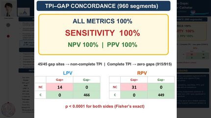 Non-complete tissue proximity indication shows perfect concordance with acute isolation gaps: an eight-segment spatial analysis during pulsed field ablation with a variable-loop circular catheter