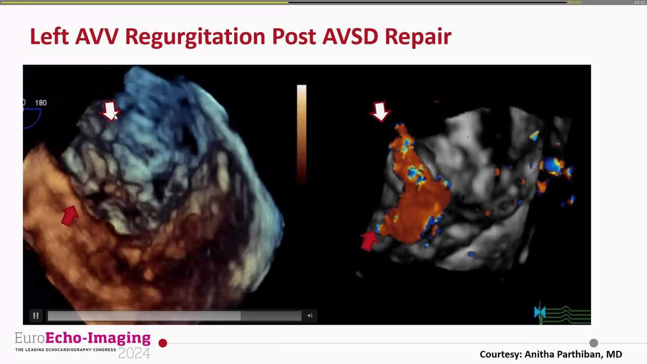 Future of 3D echocardiography in congenital heart disease: role of education, training, and technical development to meet growing requirements of ACHD clinical service