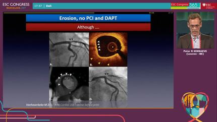 Presentation thumbnail