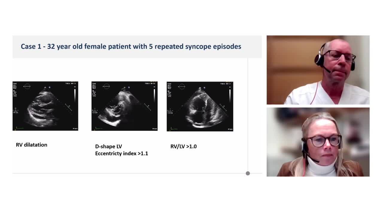 What's new in pulmonary hypertension: diagnosis and phenotyping?  
ESC 2022 Clinical Practice Guidelines webinar