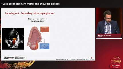 Clinical Case Management: managing multivalve disease - moving toward a staged approach