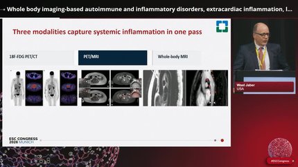 Imaging knowledge gaps in inflammatory myopericarditis syndromes and beyond