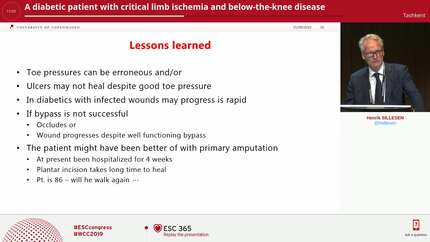 A diabetic patient with critical limb ischemia and below-the-knee disease