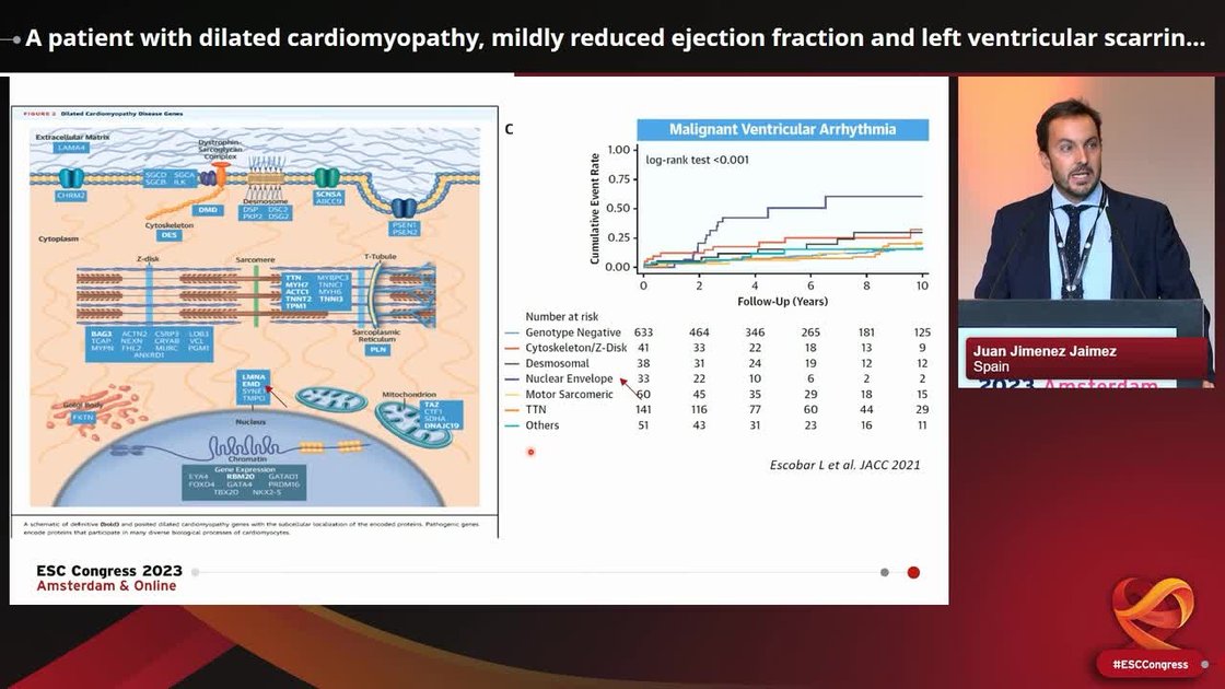 ESC 365 - A patient with dilated cardiomyopathy, mildly reduced ...