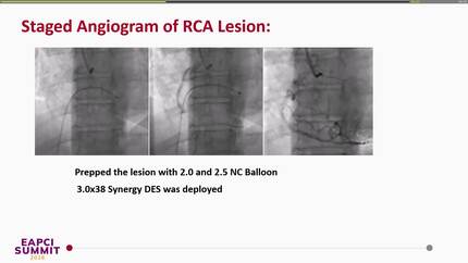 Presentation thumbnail