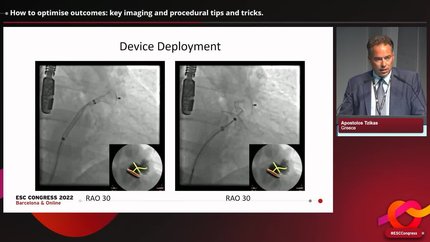 Presentation thumbnail