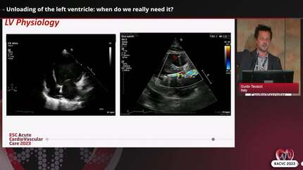 How to manage mechanical circulatory support therapy in cardiogenic shock