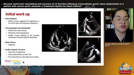 Presentation thumbnail