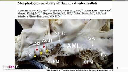 Presentation thumbnail
